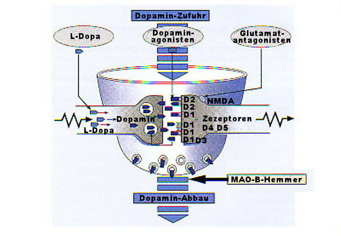 Parkinson-Hilfe 1